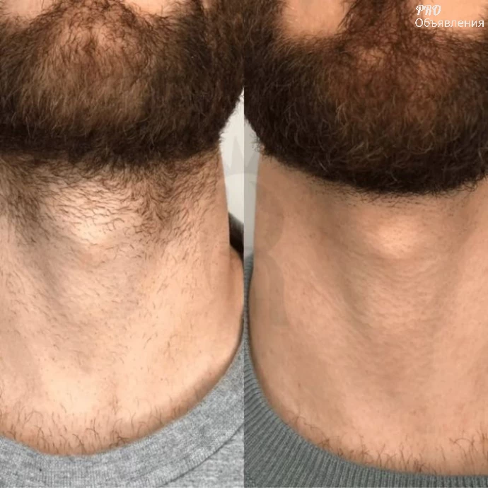 Мужская депиляция в Купчино (СПб). Юлия &mdash; 19+ лет опыта, медицинское образование 2