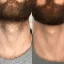 Мужская депиляция в Купчино (СПб). Юлия &mdash; 19+ лет опыта, медицинское образование