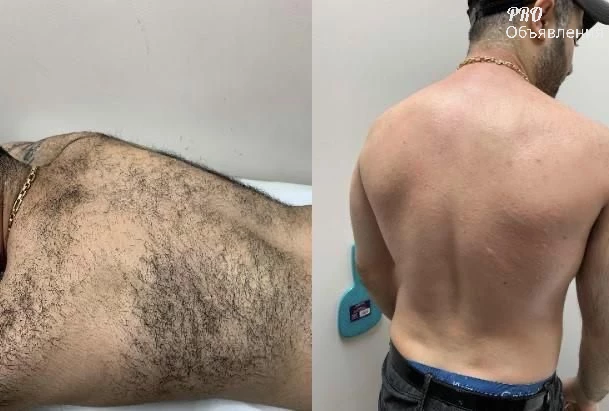 Мужская депиляция в Купчино (СПб). Юлия &mdash; 19+ лет опыта, медицинское образование 0